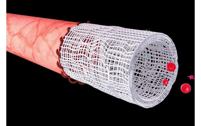 Application of Artificial Blood Vessel